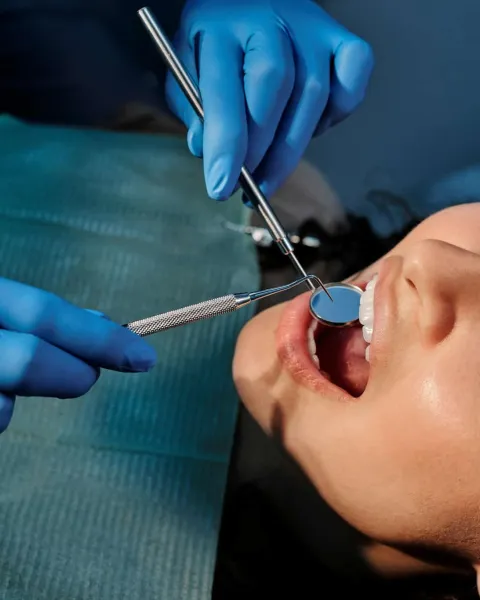 Profesional haciendo un tratamiento para la gingivitis y periodontitis